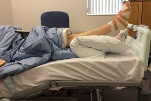 High foot and ankle elevation following surgery