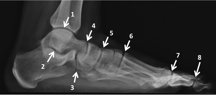 The joints of the foot  and ankle as seen from the side