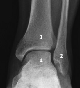 The ankle as seen from the front