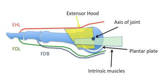 The extensor hood (yellow) implicated in claw toe